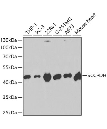 SCCPDH Rabbit Polyclonal Antibody