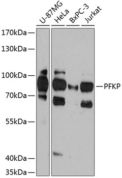 PFKP Rabbit Polyclonal Antibody