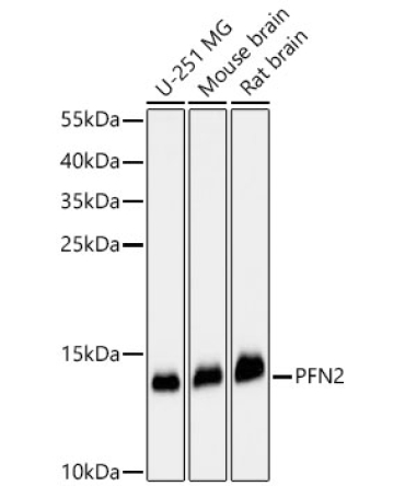 PFN2 Rabbit Polyclonal Antibody