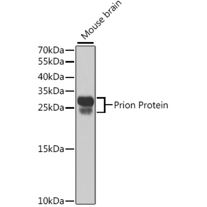 Prion Protein Rabbit Polyclonal Antibody