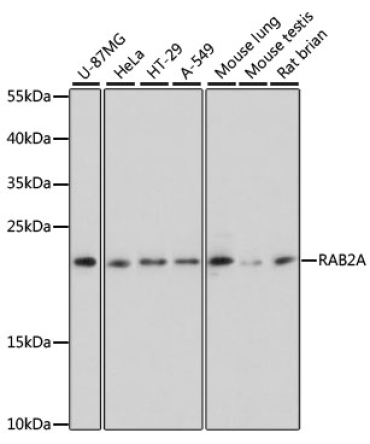 RAB2A Rabbit Polyclonal Antibody