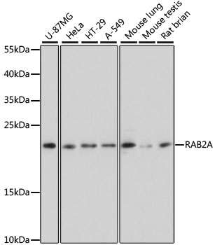 RAB2A Rabbit Polyclonal Antibody