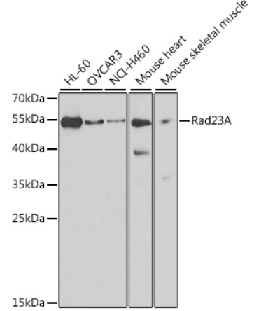Rad23A Rabbit Polyclonal Antibody