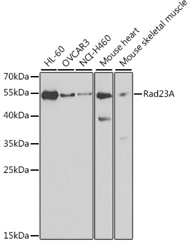 Rad23A Rabbit Polyclonal Antibody