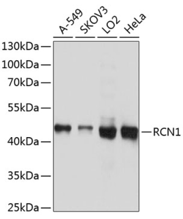RCN1 Rabbit Polyclonal Antibody