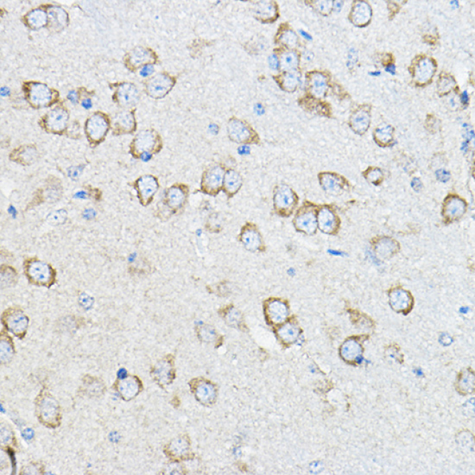 STIM1 Rabbit Polyclonal Antibody