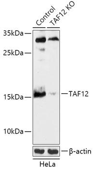 TAF12 Rabbit Polyclonal Antibody
