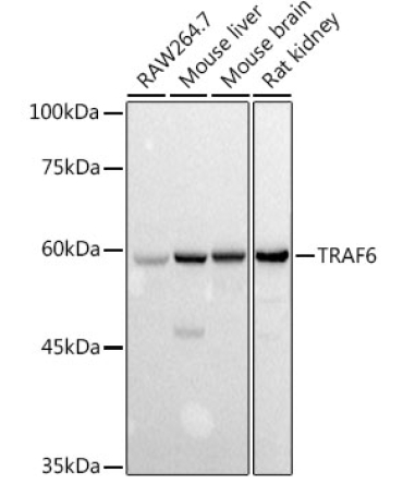 TRAF6 Rabbit Polyclonal Antibody