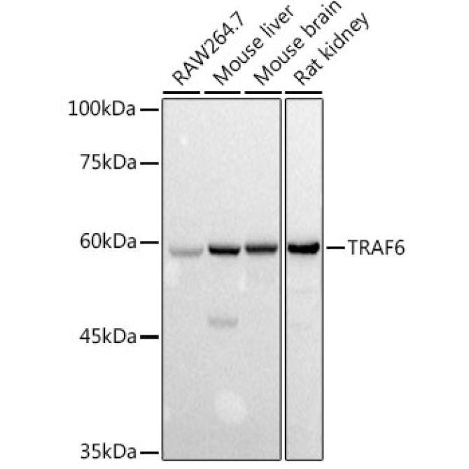TRAF6 Rabbit Polyclonal Antibody
