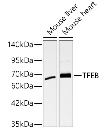 TFEB Rabbit Polyclonal Antibody