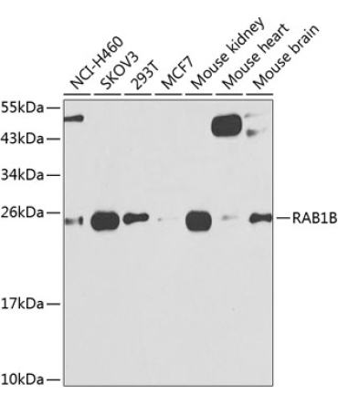 RAB1B Rabbit Polyclonal Antibody