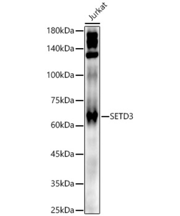 SETD3 Rabbit Polyclonal Antibody