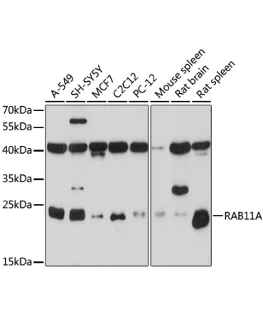 RAB11A Rabbit Polyclonal Antibody