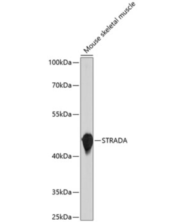 STRADA Rabbit Polyclonal Antibody