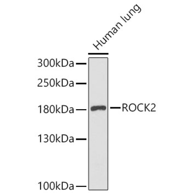 ROCK2 Rabbit Polyclonal Antibody