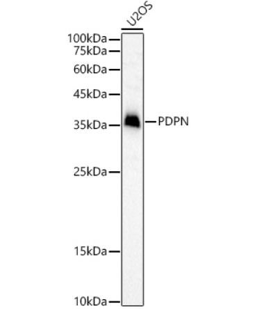 Podoplanin Rabbit Polyclonal Antibody