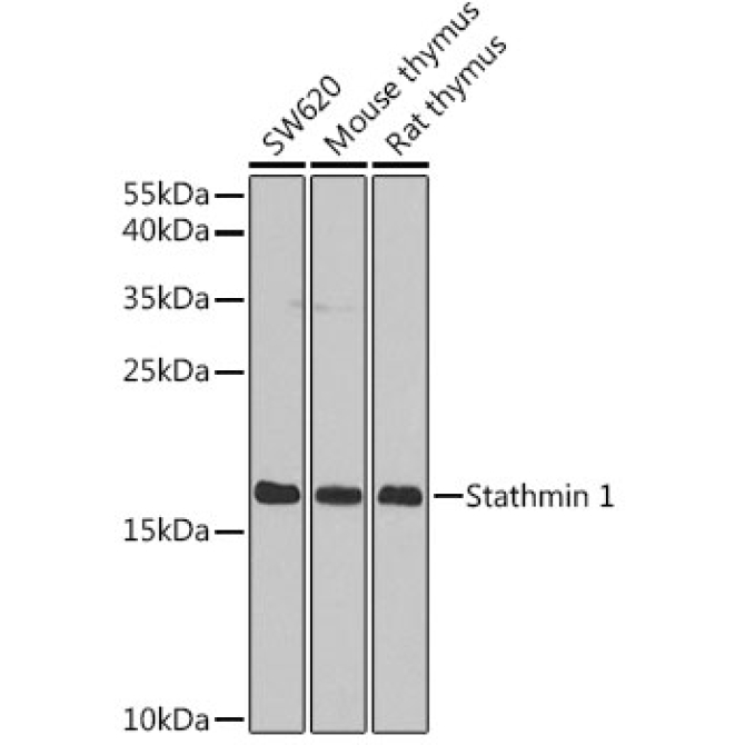 Stathmin 1 Rabbit Polyclonal Antibody