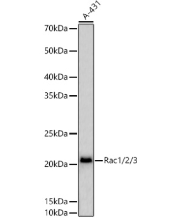 Rac1/2/3 Rabbit Polyclonal Antibody