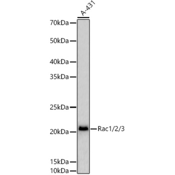 Rac1/2/3 Rabbit Polyclonal Antibody