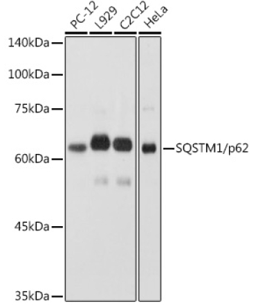 SQSTM1/p62 Rabbit Polyclonal Antibody