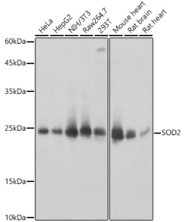 SOD2 Rabbit Polyclonal Antibody