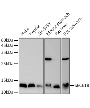 SEC61B Rabbit Polyclonal Antibody