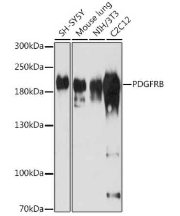 PDGFRB Rabbit Polyclonal Antibody