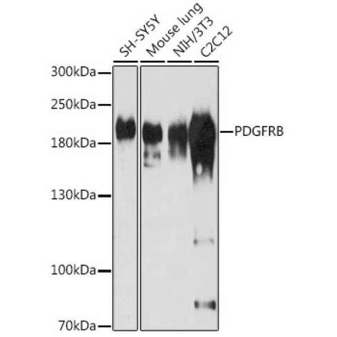 PDGFRB Rabbit Polyclonal Antibody