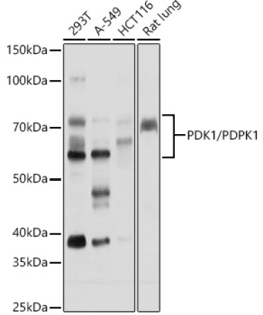 PDK1/PDPK1 Rabbit Polyclonal Antibody