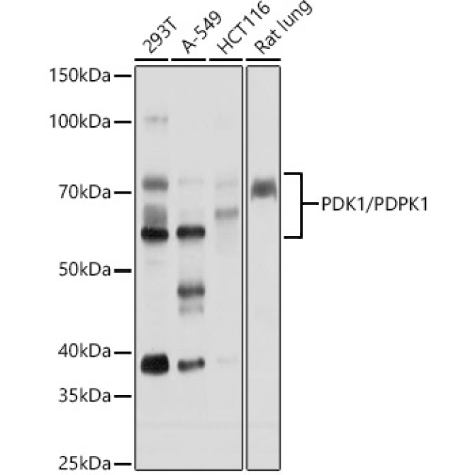PDK1/PDPK1 Rabbit Polyclonal Antibody