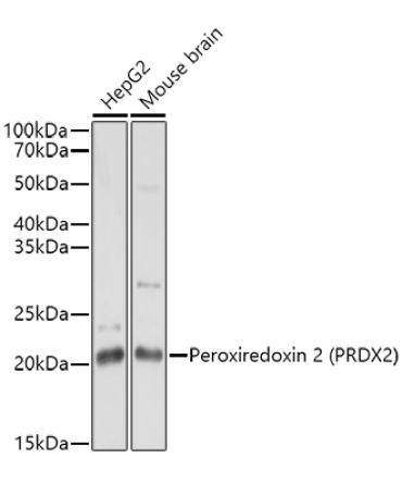 Peroxiredoxin 2 (PRDX2) Rabbit Polyclonal Antibody