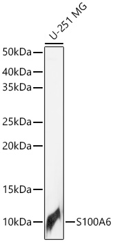 S100A6 Rabbit Polyclonal Antibody