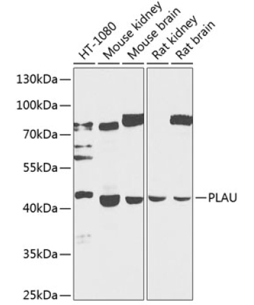 PLAU Rabbit Polyclonal Antibody