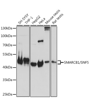 SMARCB1/SNF5 Rabbit Polyclonal Antibody