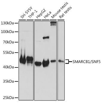 SMARCB1/SNF5 Rabbit Polyclonal Antibody