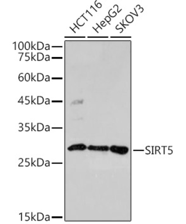 SIRT5 Rabbit Polyclonal Antibody
