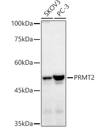 PRMT2 Rabbit Polyclonal Antibody