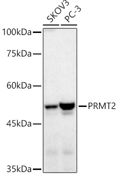 PRMT2 Rabbit Polyclonal Antibody