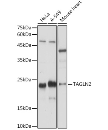 TAGLN2 Rabbit Polyclonal Antibody