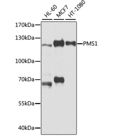 PMS1 Rabbit Polyclonal Antibody