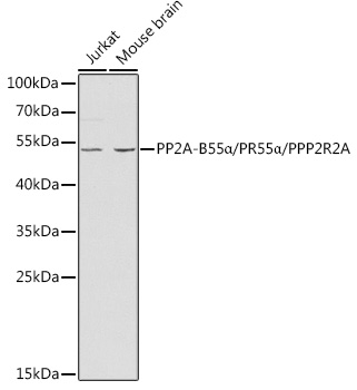 PP2A-B55Alpha/PR55Alpha/PPP2R2A Rabbit Polyclonal Antibody