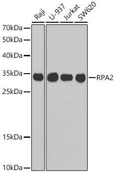 RPA2 Rabbit Polyclonal Antibody
