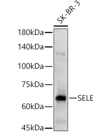 SELE Rabbit Polyclonal Antibody