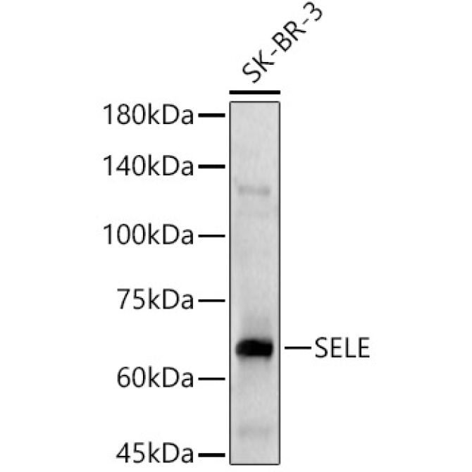 SELE Rabbit Polyclonal Antibody