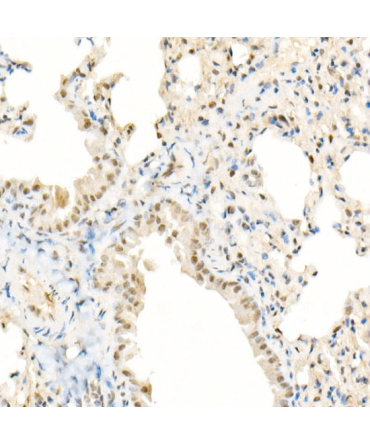 TFEB Rabbit Monoclonal Antibody