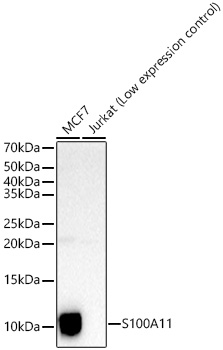 S100A11 Rabbit Polyclonal Antibody