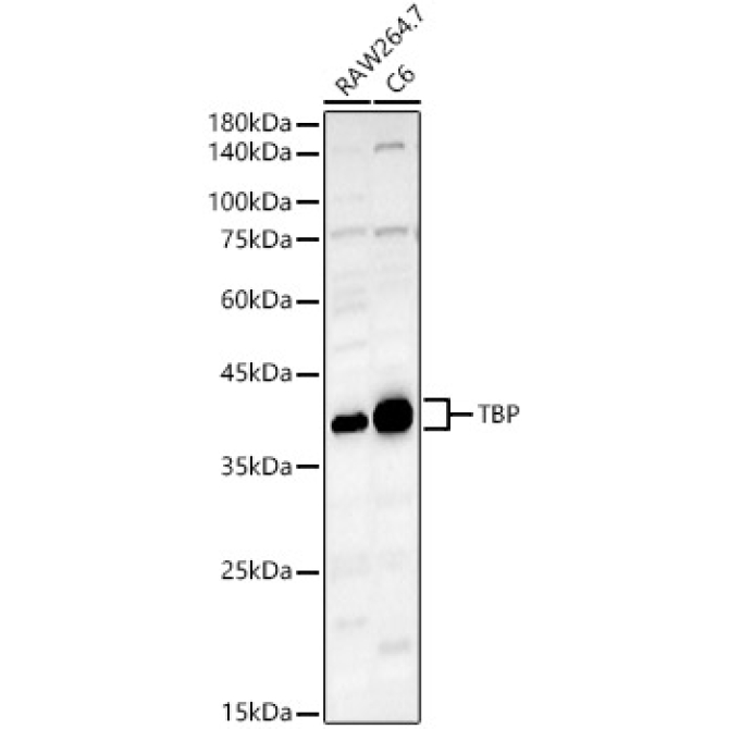 TBP Rabbit Polyclonal Antibody