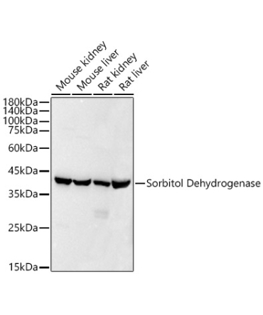 Sorbitol Dehydrogenase Rabbit Monoclonal Antibody