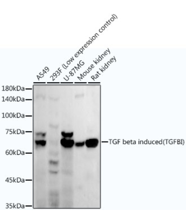 TGF beta induced (TGFBI) Rabbit Monoclonal Antibody