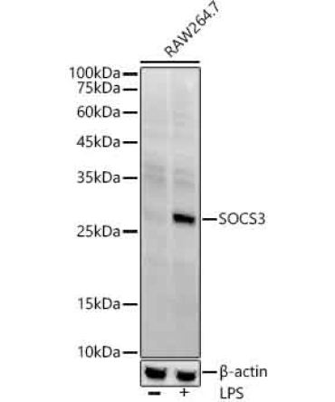 SOCS3 Rabbit Monoclonal Antibody